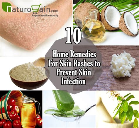 igh skin home remedies|treatment for igh.